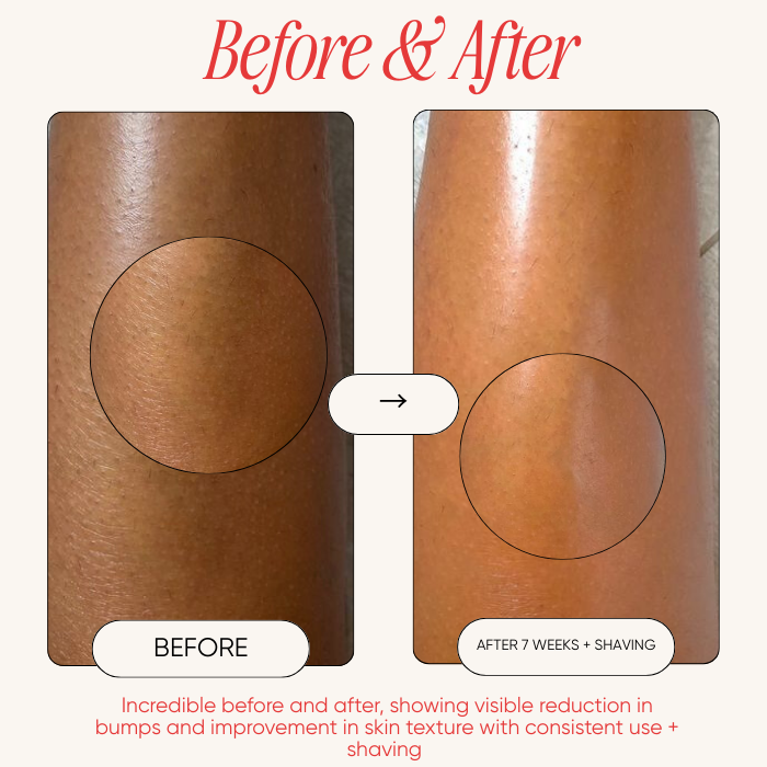 StrawberrySkincare - Seedskin Resurfacing Cream