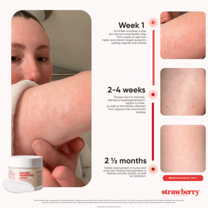 StrawberrySkincare - Seedskin Resurfacing Cream