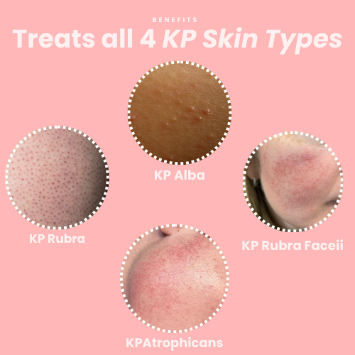 KP Exfoliating Body Cleanser