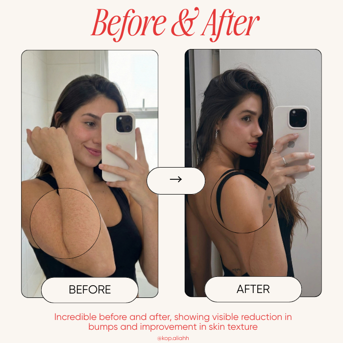 StrawberrySkincare - Seedskin Resurfacing Cream