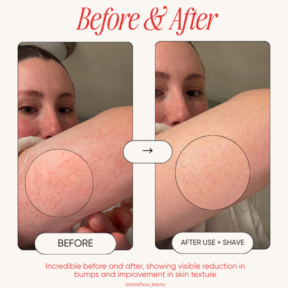 StrawberrySkincare - Seedskin Resurfacing Cream