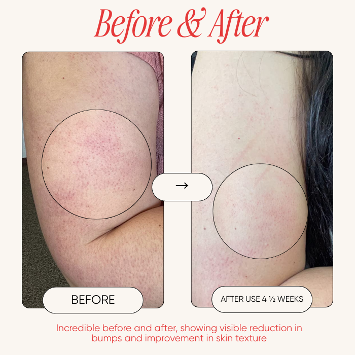 StrawberrySkincare - Seedskin Resurfacing Cream