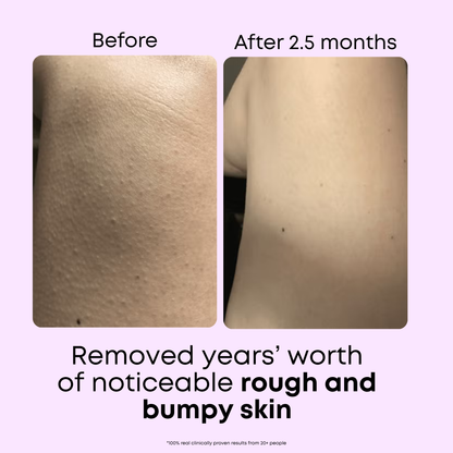 StrawberrySkincare™ KP Body Cleanser