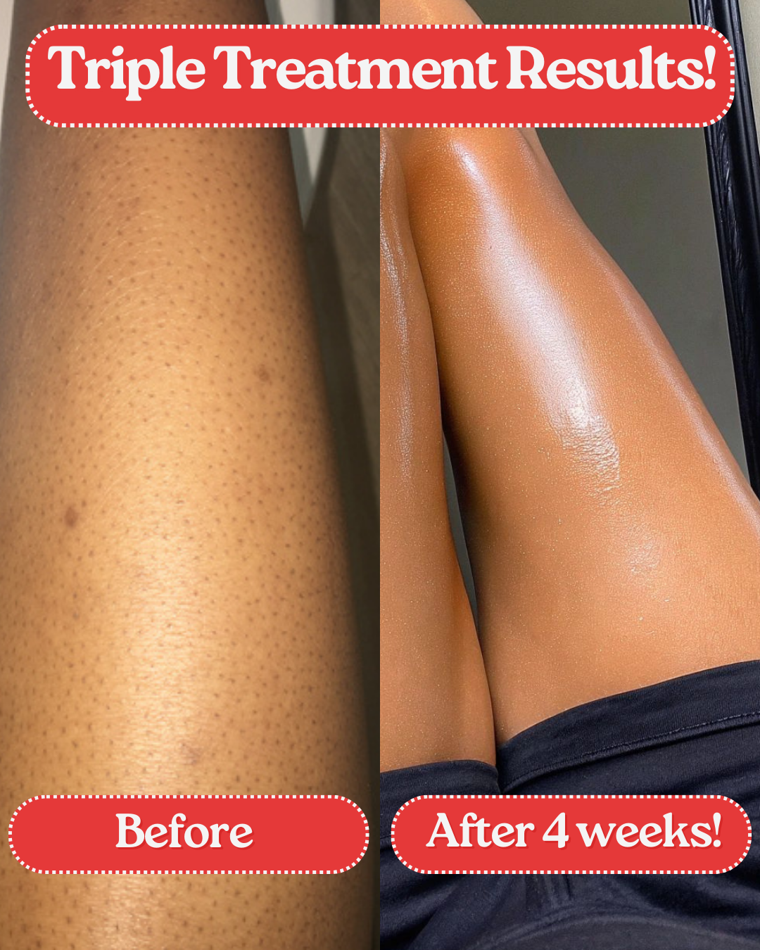 StrawberrySkincare™  - Soothing Scrub Mittens