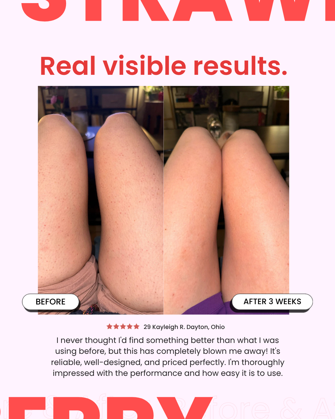 StrawberrySkincare - Seedskin Resurfacing Cream