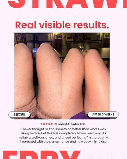 StrawberrySkincare - Seedskin Resurfacing Cream