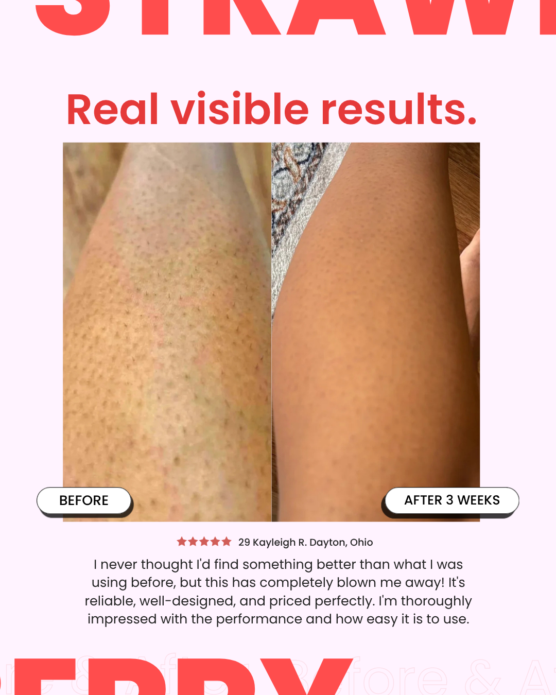 StrawberrySkincare - Seedskin Resurfacing Cream