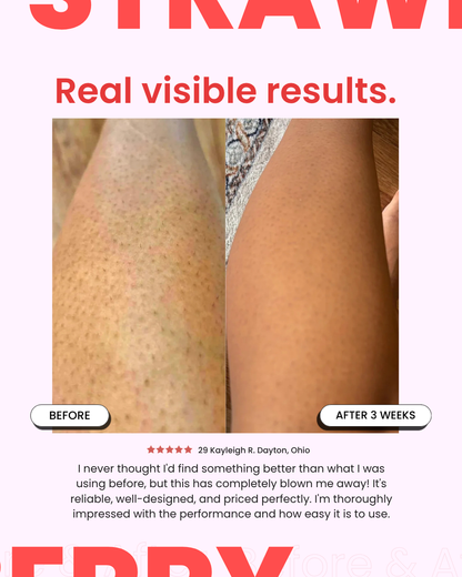 StrawberrySkincare - Seedskin Resurfacing Cream