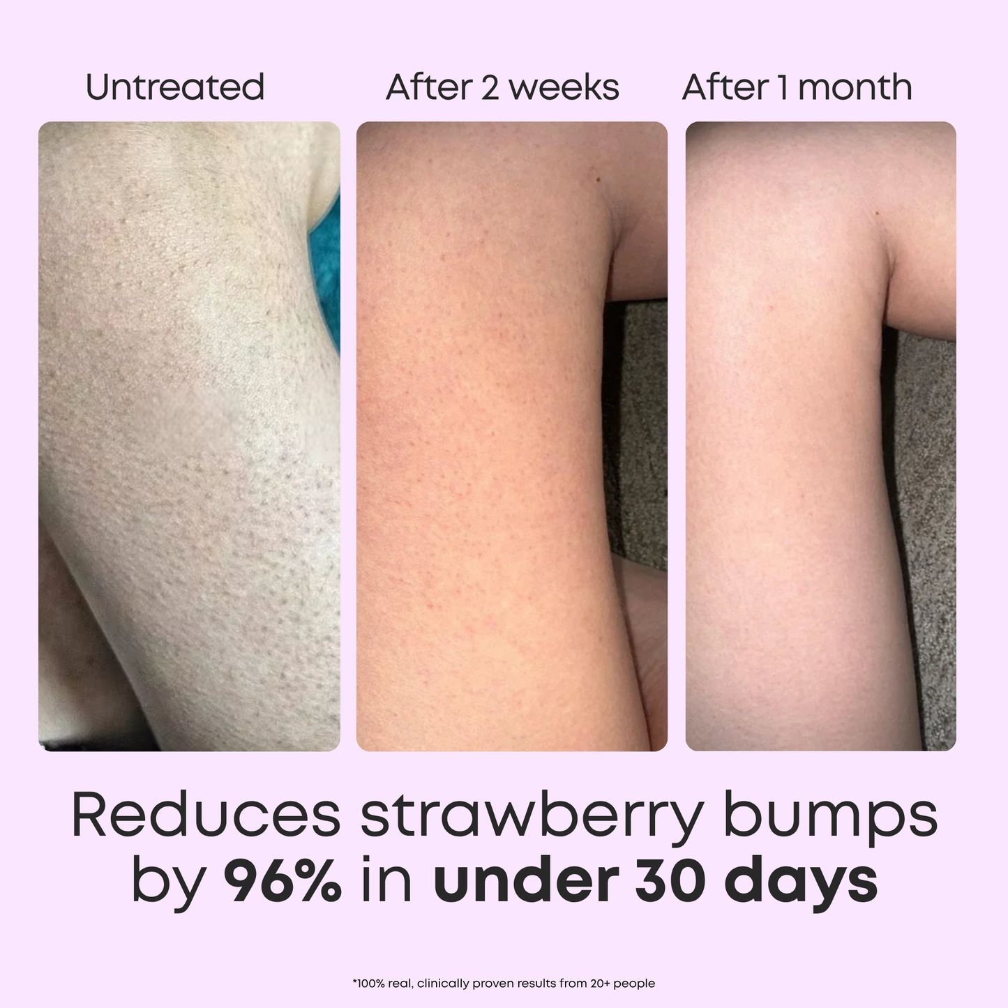 StrawberrySkincare™ KP Body Cleanser