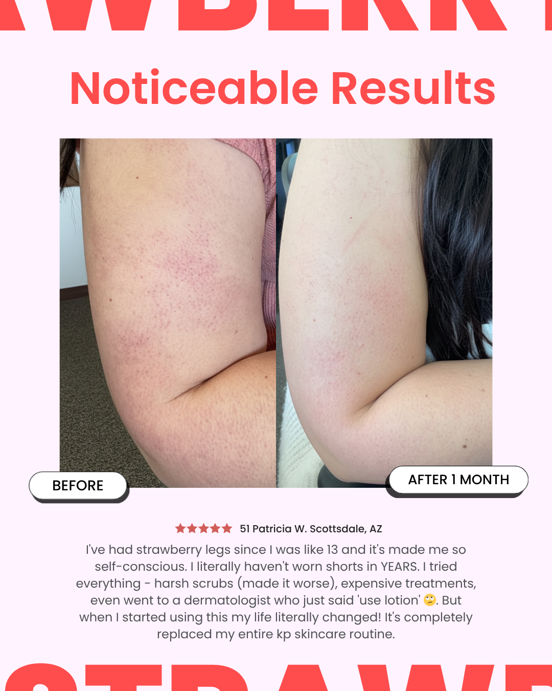 StrawberrySkincare - Seedskin Resurfacing Cream
