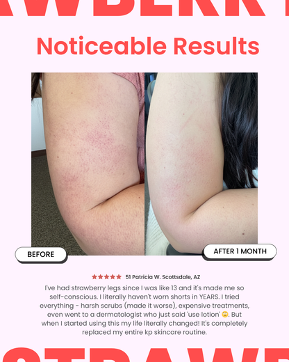 StrawberrySkincare - Seedskin Resurfacing Cream