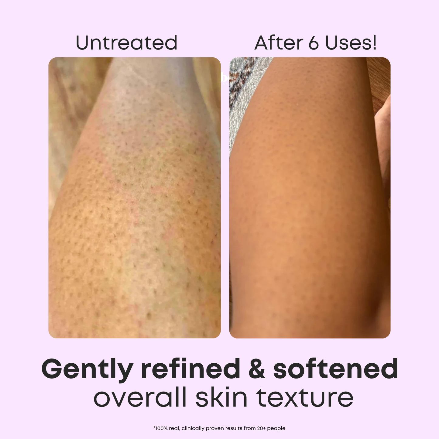 StrawberrySkincare™ KP Body Cleanser